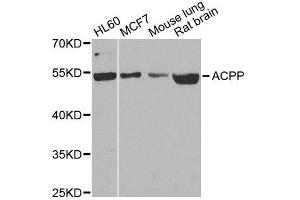 Image no. 2 for anti-Acid Phosphatase, Prostate (ACPP) antibody (ABIN3022672)