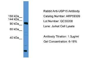 Image no. 3 for anti-Ubiquitin Specific Peptidase 15 (USP15) (C-Term) antibody (ABIN2788019)