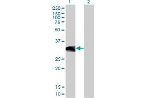 BCL11A antibody  (AA 1-88)