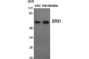 Image no. 2 for anti-Ets Variant 1 (ETV1) (N-Term) antibody (ABIN3184527)