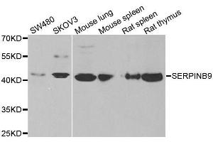 Image no. 1 for anti-serpin Peptidase Inhibitor, Clade B (Ovalbumin), Member 9 (SERPINB9) antibody (ABIN6147596)