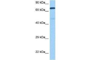 Image no. 4 for anti-Matrix Metallopeptidase 9 (Gelatinase B, 92kDa Gelatinase, 92kDa Type IV Collagenase) (MMP9) (N-Term) antibody (ABIN2777743)