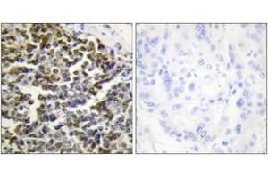 Image no. 2 for anti-Treacher Collins-Franceschetti Syndrome 1 (TCOF1) (AA 41-90) antibody (ABIN1533867)