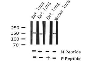 Image no. 3 for anti-Mast/stem Cell Growth Factor Receptor (KIT) (pTyr703) antibody (ABIN6255994)