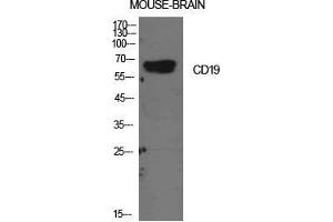 Image no. 3 for anti-CD19 Molecule (CD19) (Internal Region) antibody (ABIN3188013)