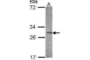 Image no. 2 for anti-Interleukin 22 Receptor, alpha 2 (IL22RA2) (Center) antibody (ABIN2855609)