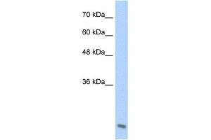 Image no. 1 for anti-Amino-terminal Enhancer of Split (AES) (C-Term) antibody (ABIN2774824)