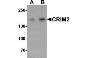Image no. 1 for anti-Kielin/Chordin-Like Protein (KCP) (C-Term) antibody (ABIN1449940)