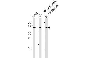 Image no. 1 for anti-Homeobox C10 (HOXC10) (AA 217-246), (C-Term) antibody (ABIN5532582)