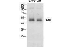 Image no. 1 for anti-Interleukin 6 Receptor, alpha (IL6RA) (Internal Region) antibody (ABIN3181401)