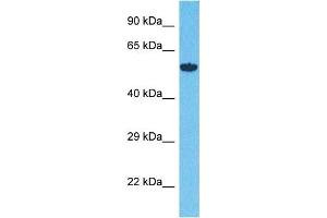 Host:  Rabbit  Target Name:  ALG12  Sample Type:  293T Whole Cell lysates  Antibody Dilution:  1.