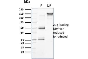 Image no. 9 for anti-Keratin 18 (KRT18) antibody (ABIN6939932)