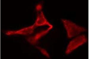 Image no. 1 for anti-Trafficking Protein Particle Complex 3 (TRAPPC3) (N-Term) antibody (ABIN6257541)