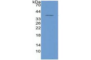 Image no. 4 for Nuclear Factor kappa B (NFkB) ELISA Kit (ABIN6730872)