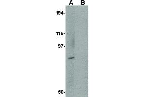 Image no. 2 for anti-Bicaudal D Homolog 1 (BICD1) (C-Term) antibody (ABIN6656938)