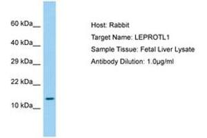 Image no. 1 for anti-Leptin Receptor Overlapping Transcript-Like 1 (LEPROTL1) (AA 37-86) antibody (ABIN6750210)