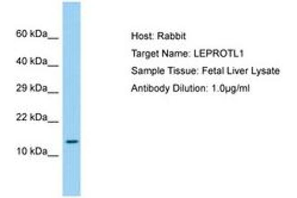 anti-Leptin Receptor Overlapping Transcript-Like 1 (LEPROTL1) (AA 37-86) antibody