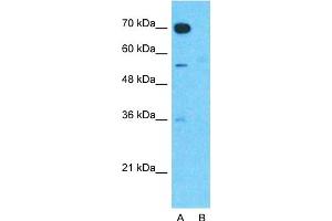 Image no. 3 for anti-Anoctamin 1, Calcium Activated Chloride Channel (ANO1) (Middle Region) antibody (ABIN2775453)