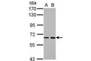 Image no. 1 for anti-SH2 Domain Containing 3A (SH2D3A) (AA 92-392) antibody (ABIN1500915)
