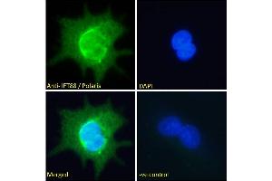 Image no. 5 for anti-Intraflagellar Transport 88 Homolog (IFT88) (C-Term) antibody (ABIN185555)
