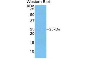 Image no. 1 for anti-Toll-Like Receptor Adaptor Molecule 2 (TICAM2) (AA 34-241) antibody (ABIN1860752)