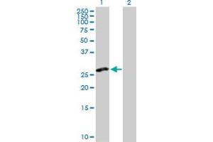 Image no. 2 for anti-C-Type Lectin Domain Family 2, Member D (CLEC2D) (AA 1-191) antibody (ABIN526096)