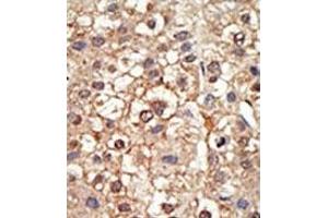 Image no. 2 for anti-Protein Inhibitor of Activated STAT, 4 (PIAS4) (N-Term) antibody (ABIN356770)