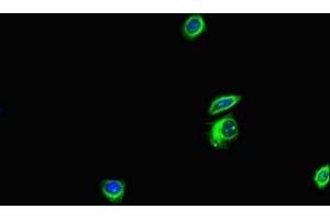 Immunofluorescent analysis of HepG2 cells using ABIN7144171 at dilution of 1:100 and Alexa Fluor 488-congugated AffiniPure Goat Anti-Rabbit IgG(H+L)