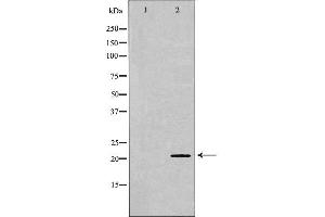 Image no. 3 for anti-Fibroblast Growth Factor 2 (Basic) (FGF2) (C-Term) antibody (ABIN6254910)