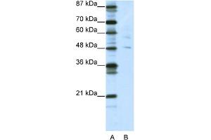 Image no. 1 for anti-Pleiomorphic Adenoma Gene-Like 1 (PLAGL1) (N-Term) antibody (ABIN2780800)