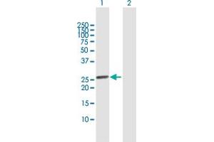 Western Blot analysis of SSX1 expression in transfected 293T cell line by SSX1 MaxPab polyclonal antibody.