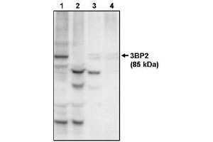 Image no. 1 for anti-SH3-Domain Binding Protein 2 (SH3BP2) antibody (ABIN264981)