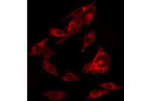 Image no. 2 for anti-V-Erb-A erythroblastic Leukemia Viral Oncogene Homolog 4 (Avian) (ERBB4) (pTyr1284) antibody (ABIN6256632)