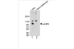 Image no. 4 for anti-Lysosomal-Associated Membrane Protein 2 (LAMP2) antibody (ABIN650660)