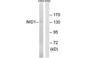 Image no. 1 for anti-Nidogen 1 (NID1) (AA 219-268) antibody (ABIN1535111)