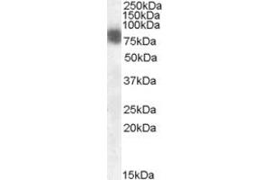 Image no. 2 for anti-Cortactin (CTTN) (N-Term) antibody (ABIN184659)