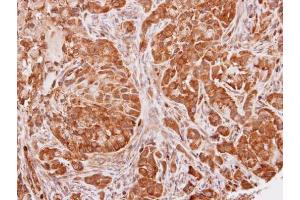 IHC-P Image Immunohistochemical analysis of paraffin-embedded A549 xenograft, using SEC13L1, antibody at 1:100 dilution.
