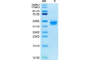 IL12B Protein (His tag)