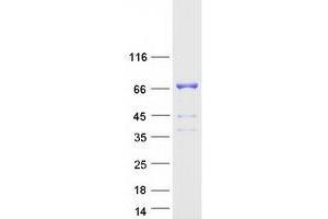 Image no. 1 for Dihydrolipoyl Transacetylase (DLAT) protein (Myc-DYKDDDDK Tag) (ABIN2719517)