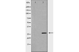 Image no. 2 for anti-Interleukin 27 (IL27) (Internal Region) antibody (ABIN6262558)