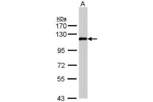 Image no. 4 for anti-Zinc Fingers and Homeoboxes 2 (ZHX2) (C-Term) antibody (ABIN2856852)