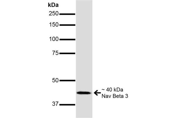 anti-Sodium Channel, Voltage-Gated, Type III, beta Subunit (SCN3B) (AA 1-215) antibody