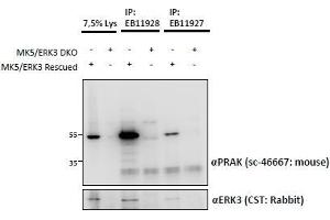 Image no. 1 for anti-Mitogen-Activated Protein Kinase-Activated Protein Kinase 5 (MAPKAPK5) (Internal Region) antibody (ABIN1590011)