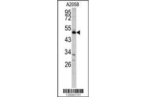 Image no. 1 for anti-Growth Arrest-Specific 7 (GAS7) (C-Term) antibody (ABIN2439419)