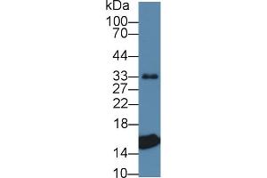 Image no. 5 for anti-Transthyretin (TTR) (AA 21-150) antibody (ABIN1863252)