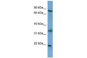 Image no. 1 for anti-Chemokine (C-C Motif) Ligand 17 (CCL17) (N-Term) antibody (ABIN928024)