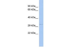 Image no. 1 for anti-Outer Dense Fiber of Sperm Tails 4 (ODF4) (N-Term) antibody (ABIN2785245)