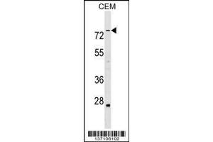 Image no. 1 for anti-Actin Binding LIM Protein Family, Member 3 (ABLIM3) (AA 613-641), (C-Term) antibody (ABIN1537502)