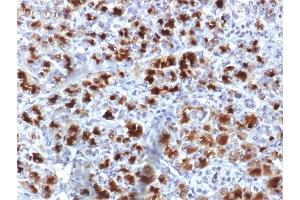 Elastase 3B antibody  (AA 82-238)