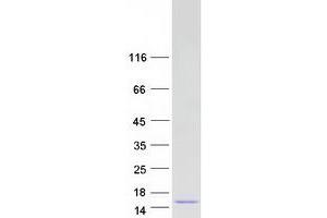 Image no. 1 for Catenin, beta Interacting Protein 1 (CTNNBIP1) (Transcript Variant 1) protein (Myc-DYKDDDDK Tag) (ABIN2712613)